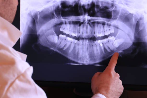 Best Emergency Treatment for Dental Infections or Abscesses in Deans, NJ